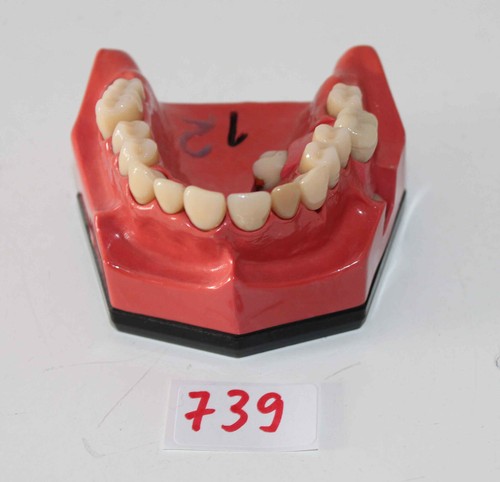 Dent schaumodell 1 - go,