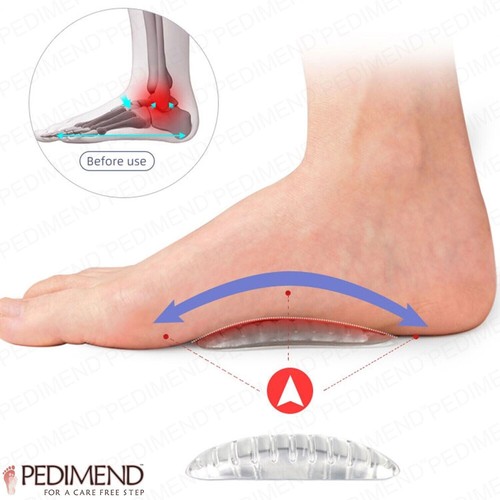 Pedimend silikon bogen - pedimend,