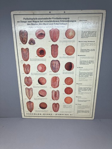 Alte lehrtafel pathologische - lehrtafel,
