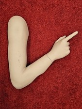 Hindsgaul Arm und Hand rechts