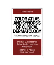 Color Atlas and Synopsis of Clinical Dermatology: Common and Serious Diseases, J