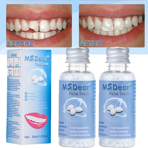 Provisorischer zahnersatz - 2x,
