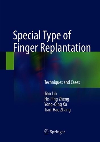 Special type finger - of,