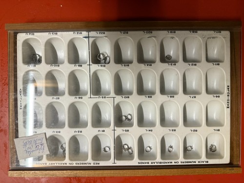 Molar kronen kit set kfo - kronen, /