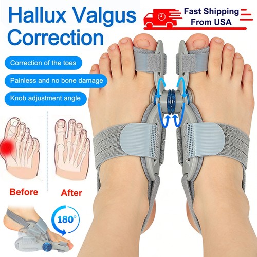 Hallux valgus korrektur - hallux,
