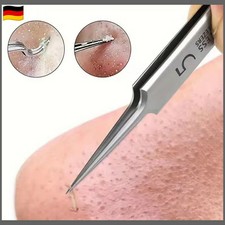 Pickel Mitesser Akne Haar