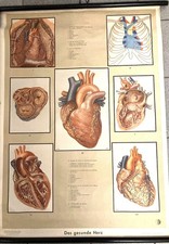 Schulwandkarte: " HERZ "