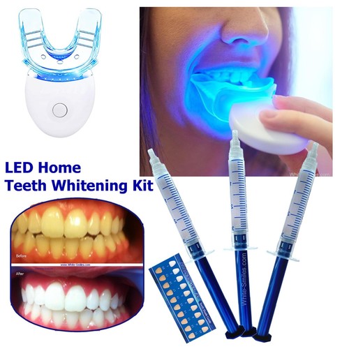 Zahnaufhellungsset gel led - zahnaufhellungsset,