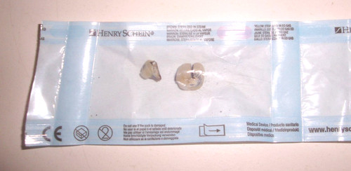 Zahngold bruchgold altgold - -,