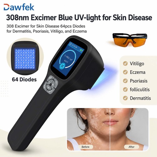 Handheld 308nm excimer lamp - handheld,