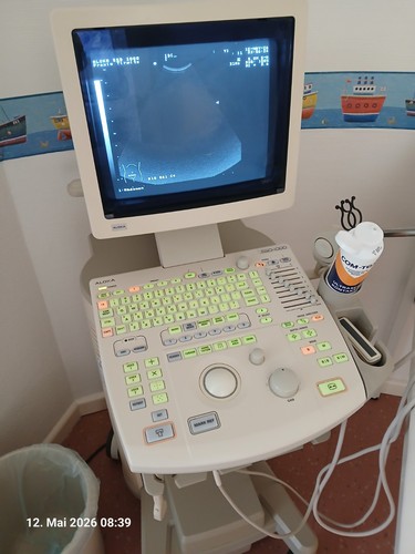 Sonografiegerät pädiatrie - sonografiegerät,