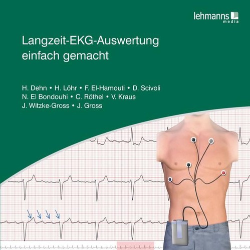 Langzeit-EKG-Auswertung