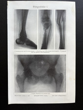 antike Grafik Medizin /