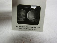 MICRO X RAY RECORDER MEDICAL