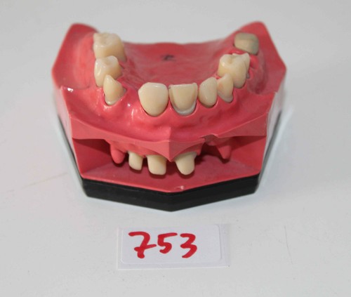 Dent schaumodell 5 - go,