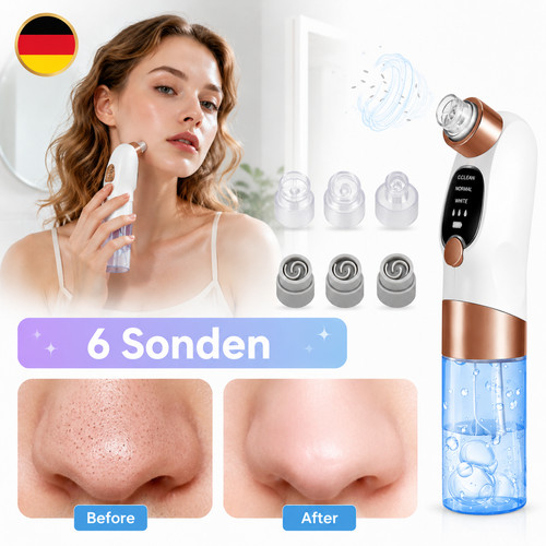 Sonden mitesser entferner - 6,