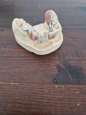 Schaumodell Modellgus Prothese Zahnersatz Patienteninformation, Zahntechnik 