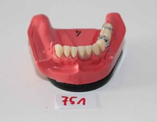 Dent schaumodell 4 - dent,
