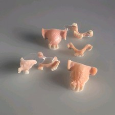 7 Stück Zahn - Prothesen,  Dentalschrott , verschiedene Größen