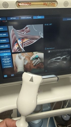 Esaote mylab one neue sonde - esaote,