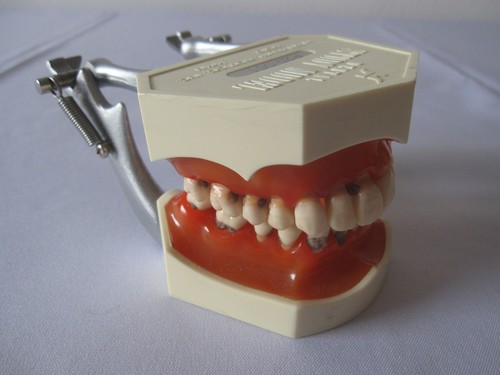 Zahngebiss parodontiemodel - zahngebiss-,