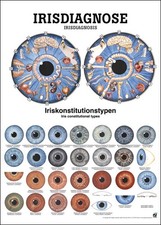 Lehrtafel irisdiagnose - lehrtafel,