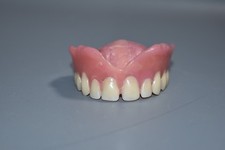 Zahnersatz Zähne Gebiss