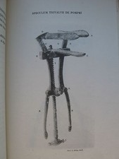 antike Chirurgie-V.Deneffe-La Speculum de la Matrice-Gynäkologie Frauenarzt 1902
