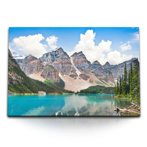 120x80cm wandbild auf - wandbild, leinwand