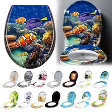 Klodeckel Toilettendeckel