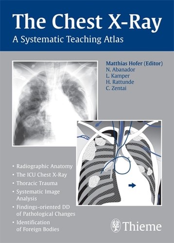 The chest ray a systematic - a,