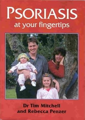 Psoriasis your fingertips - your,