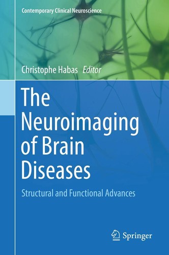 The neuroimaging brain - the,