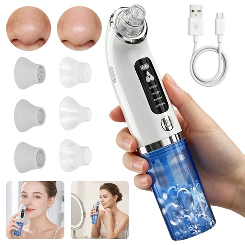 Mikrodermabrasion