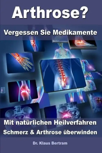 Arthrose vergessen sie - arthrose?,