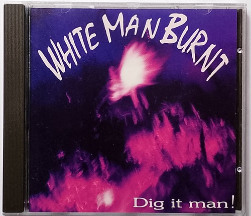 White man burnt - -,