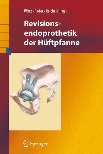 Revisionsendoprothetik der