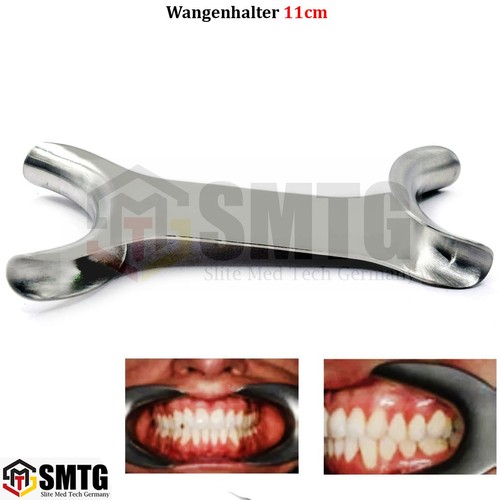 Kfo lippen zungen wangenhalter - zungen,