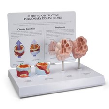 COPD Anatomical Model Set
