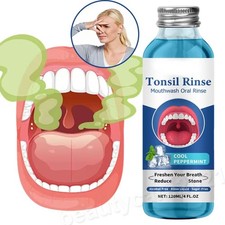 Natural tonsil stone - 20/5x,