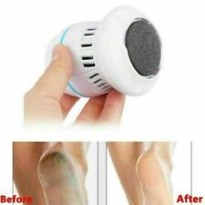 Elektrischer Schwielenentferner Beseitigt harte Füße Pediküre trockene abgestorbene Haut 