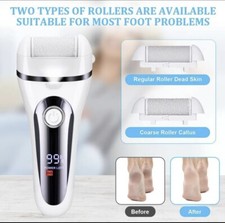 ACWOO elektrische Fußfeile, 4 in 1 kabelloser Epilierer für Frauen und elektrischer Fuß F