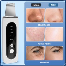 Ultraschallpeelinggerät Porenreiniger Skin Scrubber Ultraschall Peeling Retoo DE