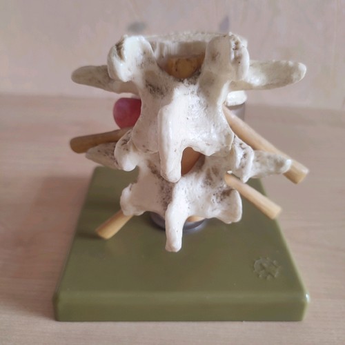 Medizinisches modell - medizinisches,