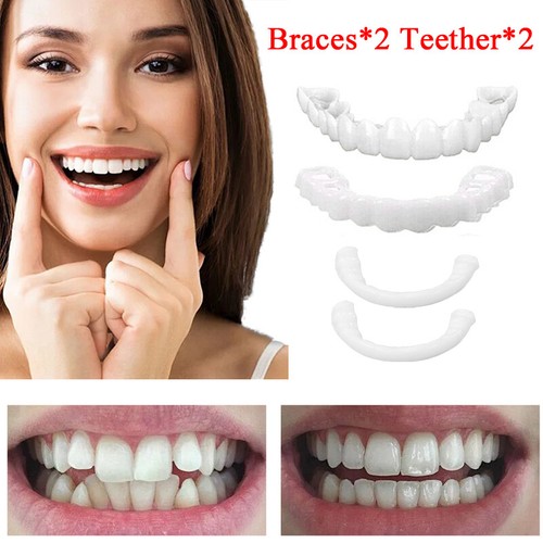 Cosmetic top bottom veneers - top,