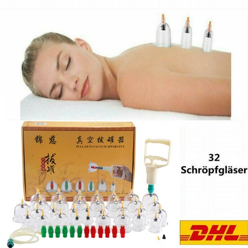 Schröpfen set mit - schröpfen,