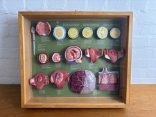 Vintage SOMSO Schaukasten Modell Befruchtung Ei Mensch Fortpflanzung Mid Century