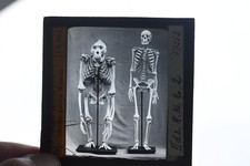 Alt Foto Bild | Anatomie