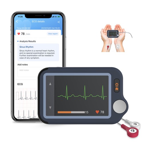 Checkme plus ekg - ekg-gerät, für