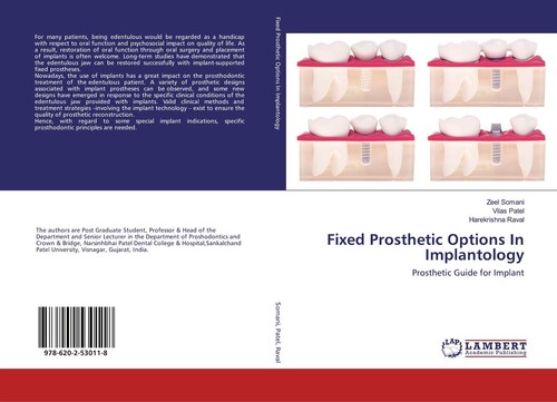 Fixed prosthetic options - prosthetic,